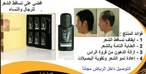 Hair loss cure hair transplant  hair loss treatment  hair loss in women 6 * 50ml