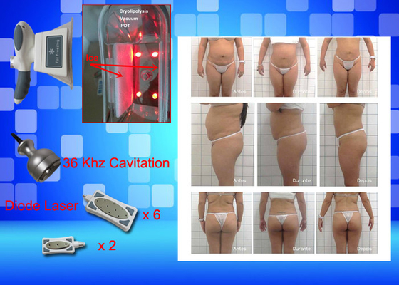 Cryo Freezing Laser Lipo Equipment Weight Lose Home Beauty Machine
