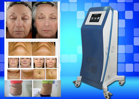 Cryo Freezing Laser Lipo Equipment Weight Lose Home Beauty Machine